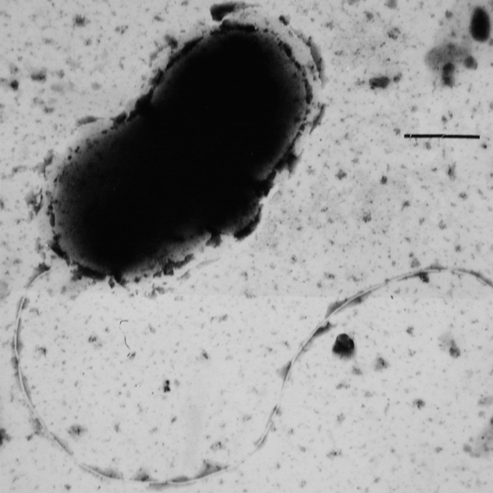desulfovibrio vulgaris